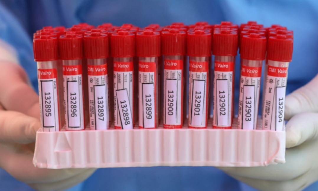 1 147 са новите случаи на коронавирус в България показват